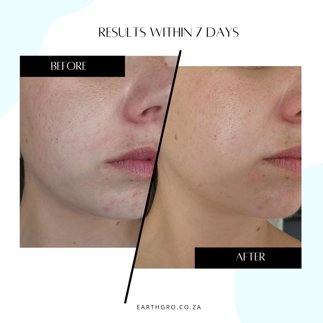 ELIXIRIVE face serum (acmella oleracea 1.5%)