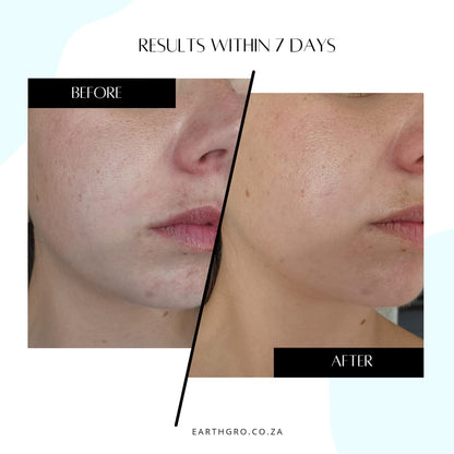 ELIXIRIVE face serum (acmella oleracea 1.5%)