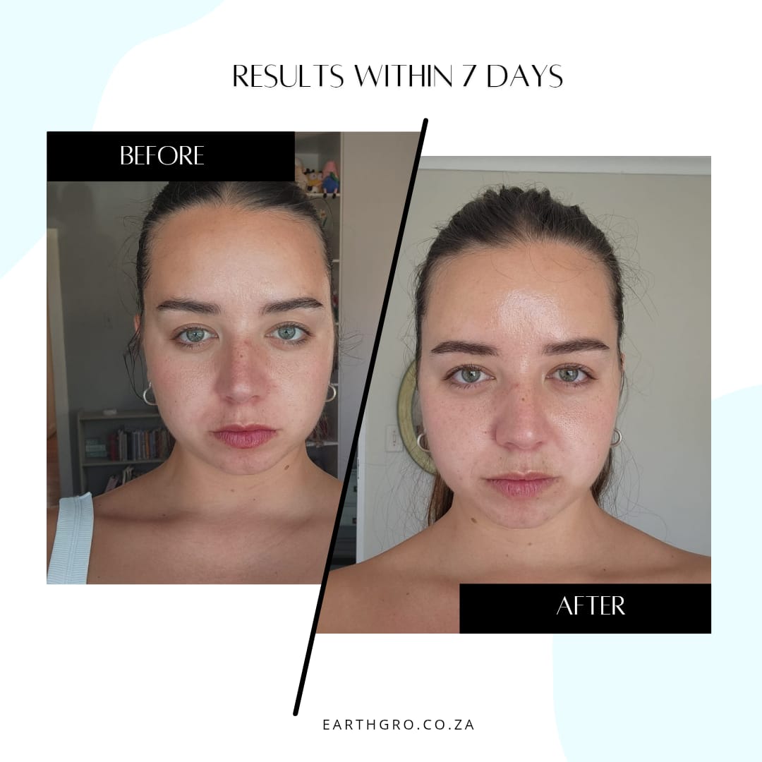 ELIXIRIVE face serum (acmella oleracea 1.5%)