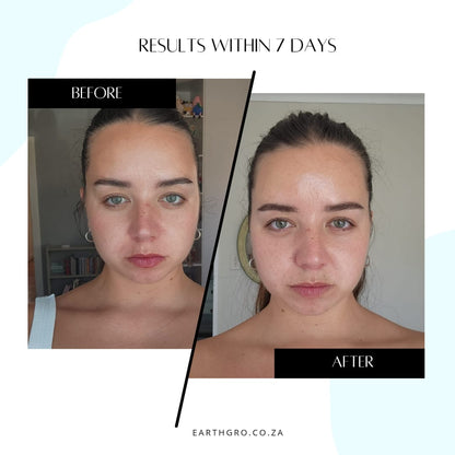 ELIXIRIVE face serum (acmella oleracea 1.5%)