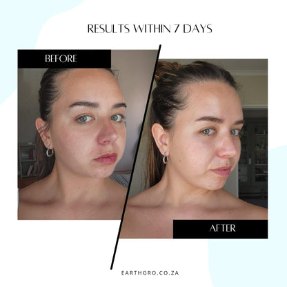 ELIXIRIVE face serum (acmella oleracea 1.5%)